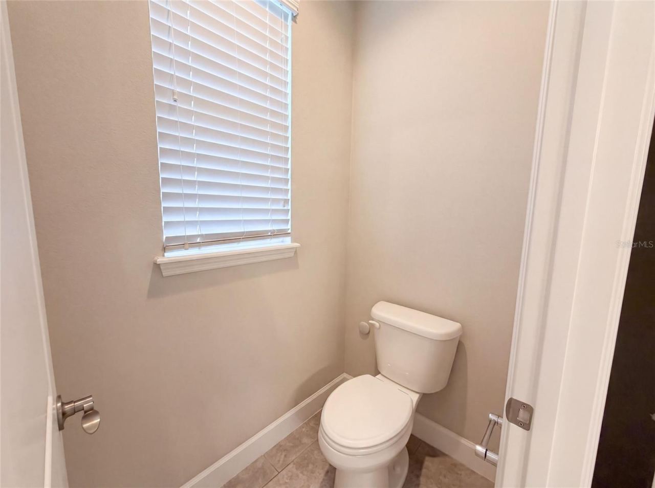 Photo 15 of 20
